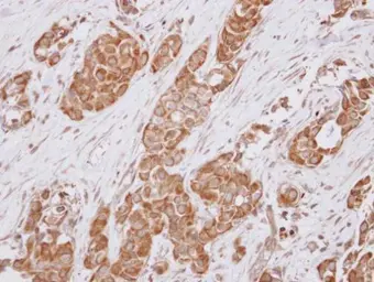 Anti-ALS2CR1 antibody [N3C3] used in IHC (Paraffin sections) (IHC-P). GTX116727