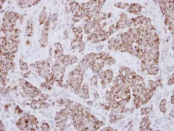 Anti-MCCC2 antibody used in IHC (Paraffin sections) (IHC-P). GTX116739