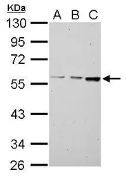 Anti-MCCC2 antibody used in Western Blot (WB). GTX116739