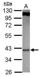 Anti-mLST8 / GBL antibody [N2C3] used in Western Blot (WB). GTX116747