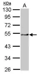 Anti-NARFL antibody used in Western Blot (WB). GTX116764