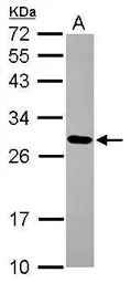 Anti-MRPL9 antibody [N2C3] used in Western Blot (WB). GTX116779