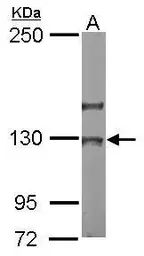 Anti-NOL6 antibody [C2C3], C-term used in Western Blot (WB). GTX116786