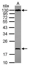 Anti-NOL6 antibody [C2C3], C-term used in Western Blot (WB). GTX116786