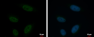 Anti-KCTD15 antibody used in Immunocytochemistry/ Immunofluorescence (ICC/IF). GTX116797