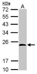 Anti-KCTD15 antibody used in Western Blot (WB). GTX116797