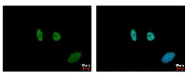 Anti-SMC6L1 antibody [N3C2], Internal used in Immunocytochemistry/ Immunofluorescence (ICC/IF). GTX116832