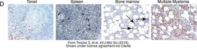 Anti-CLPTM1L antibody [N1C1] used in IHC (Paraffin sections) (IHC-P). GTX116893