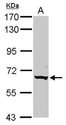 Anti-CLPTM1L antibody [N1C1] used in Western Blot (WB). GTX116893