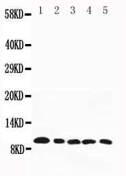 Anti-MIP1 beta antibody used in Western Blot (WB). GTX11695