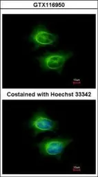 Anti-ASCC2 antibody [N3C2], Internal used in Immunocytochemistry/ Immunofluorescence (ICC/IF). GTX116950