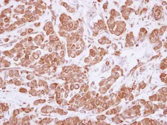 Anti-ASCC2 antibody [N3C2], Internal used in IHC (Paraffin sections) (IHC-P). GTX116950