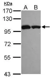 Anti-ASCC2 antibody [N3C2], Internal used in Western Blot (WB). GTX116950