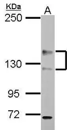 Anti-ADAMTS18 antibody used in Western Blot (WB). GTX117039