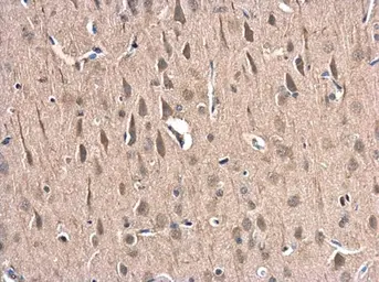 Anti-HIP1R antibody [N1N2], N-term used in IHC (Paraffin sections) (IHC-P). GTX117072