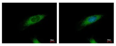 Anti-HIP1R antibody [N1N2], N-term used in Immunocytochemistry/ Immunofluorescence (ICC/IF). GTX117072