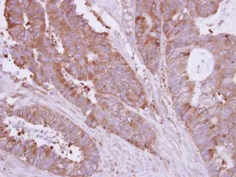 Anti-HIP1R antibody [N1N2], N-term used in IHC (Paraffin sections) (IHC-P). GTX117072