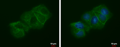 Anti-LIN7A antibody [N1C3] used in Immunocytochemistry/ Immunofluorescence (ICC/IF). GTX117114