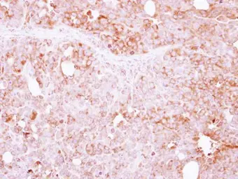 Anti-LIN7A antibody [N1C3] used in IHC (Paraffin sections) (IHC-P). GTX117114