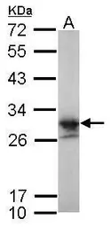 Anti-LIN7A antibody [N1C3] used in Western Blot (WB). GTX117114