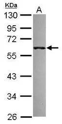 Anti-RNF36 antibody [C1C3] used in Western Blot (WB). GTX117304