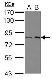 Anti-BRAT1 antibody [N1N2], N-term used in Western Blot (WB). GTX117317