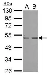 Anti-SETD7 antibody [N1C1] used in Western Blot (WB). GTX117333