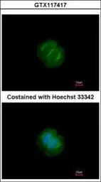 Anti-Tankyrase antibody used in Immunocytochemistry/ Immunofluorescence (ICC/IF). GTX117417