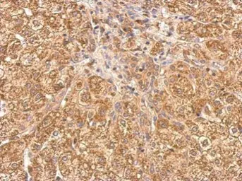 Anti-Tankyrase antibody used in IHC (Paraffin sections) (IHC-P). GTX117417