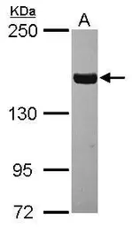 Anti-Tankyrase antibody used in Western Blot (WB). GTX117417