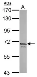 Anti-Kv4.3 antibody [C2C3], C-term used in Western Blot (WB). GTX117471