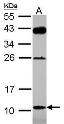 Anti-G72 antibody used in Western Blot (WB). GTX117488