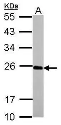 Anti-IL17C antibody used in Western Blot (WB). GTX117514