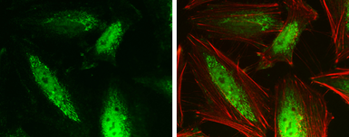 Anti-GPS2 antibody used in Immunocytochemistry/ Immunofluorescence (ICC/IF). GTX117560