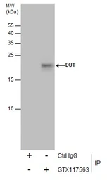 Anti-DUT antibody used in Immunoprecipitation (IP). GTX117563