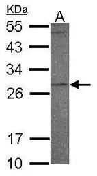 Anti-PR3 antibody [N2C3] used in Western Blot (WB). GTX117576