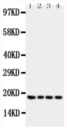 Anti-Interferon gamma antibody used in Western Blot (WB). GTX11759