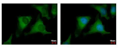 Anti-NUDC antibody used in Immunocytochemistry/ Immunofluorescence (ICC/IF). GTX117622