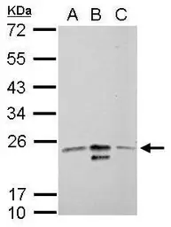 Anti-MRRF antibody used in Western Blot (WB). GTX117629