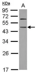 Anti-WDR4 antibody used in Western Blot (WB). GTX117701