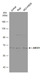 Anti-ABCE1 antibody used in Western Blot (WB). GTX117706