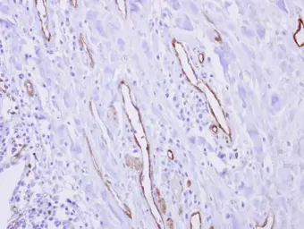 Anti-CRIP2 antibody [N1C3-2] used in IHC (Paraffin sections) (IHC-P). GTX117712