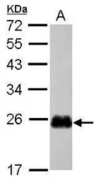 Anti-CRIP2 antibody [N1C3-2] used in Western Blot (WB). GTX117712