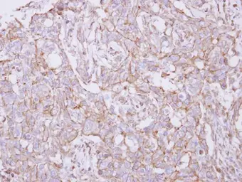 Anti-TXNDC9 antibody [N1C3-2] used in IHC (Paraffin sections) (IHC-P). GTX117713