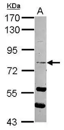 Anti-RASEF antibody [C2C3], C-term used in Western Blot (WB). GTX117780