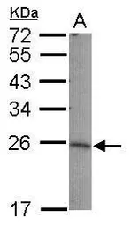 Anti-LIN7B antibody [N1C3] used in Western Blot (WB). GTX117787