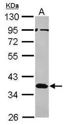 Anti-Musashi 2 antibody [N1C1] used in Western Blot (WB). GTX117808