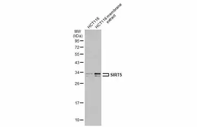 Anti-SIRT5 antibody used in Western Blot (WB). GTX117824