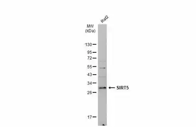 Anti-SIRT5 antibody used in Western Blot (WB). GTX117824