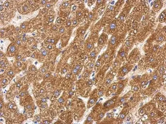 Anti-SIRT5 antibody used in IHC (Paraffin sections) (IHC-P). GTX117824